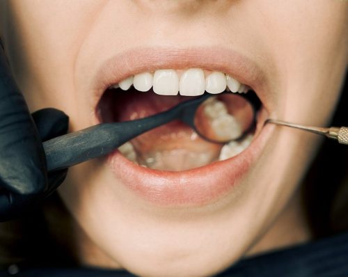 Endodoncia
