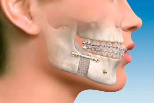 cirugia-maxilofacial-cabecera