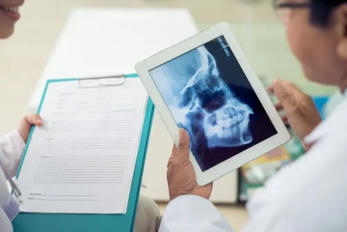 radiografia-de-craneo