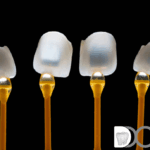 Carillas de composite