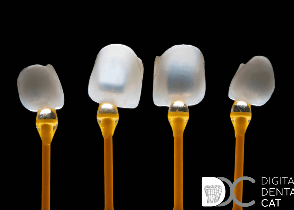 Carillas de composite