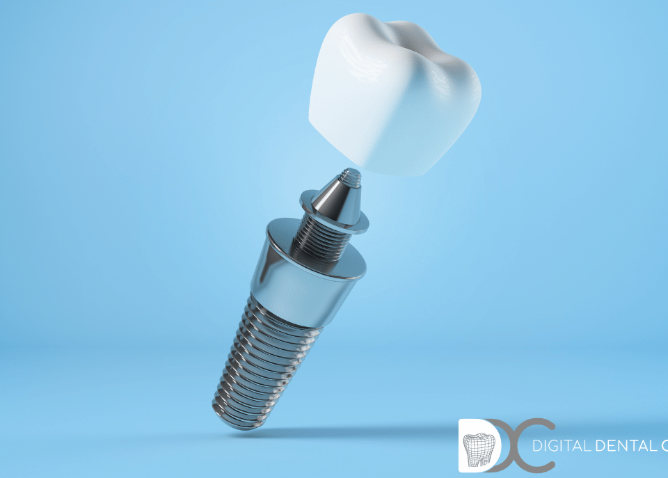 Implantes poco hueso