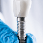 Sedación en implantología dental