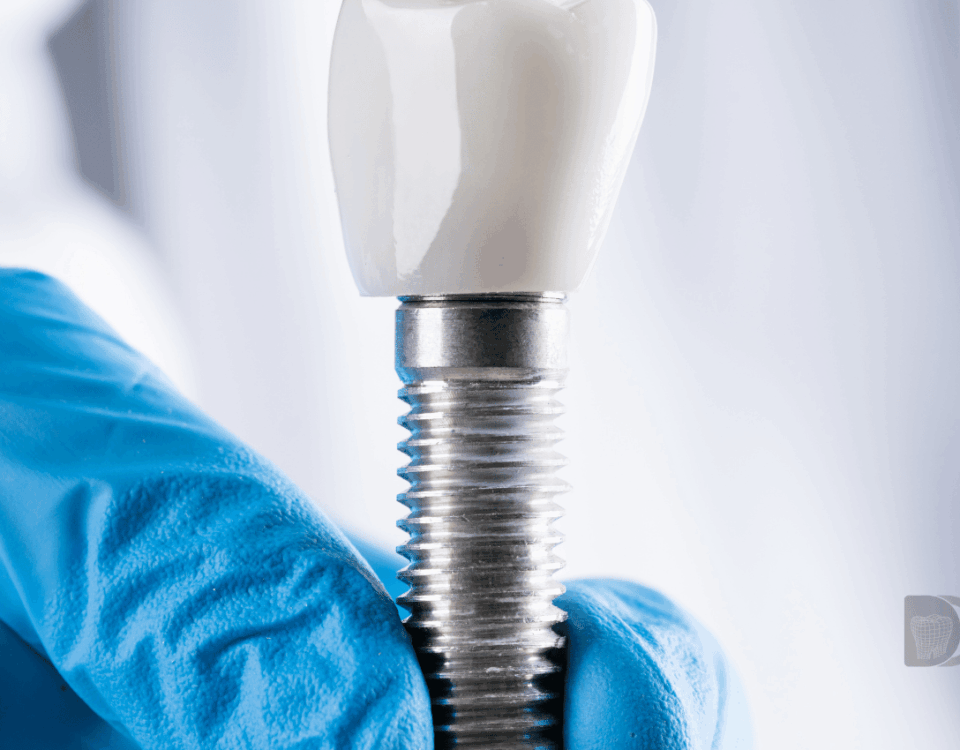 Sedación en implantología dental