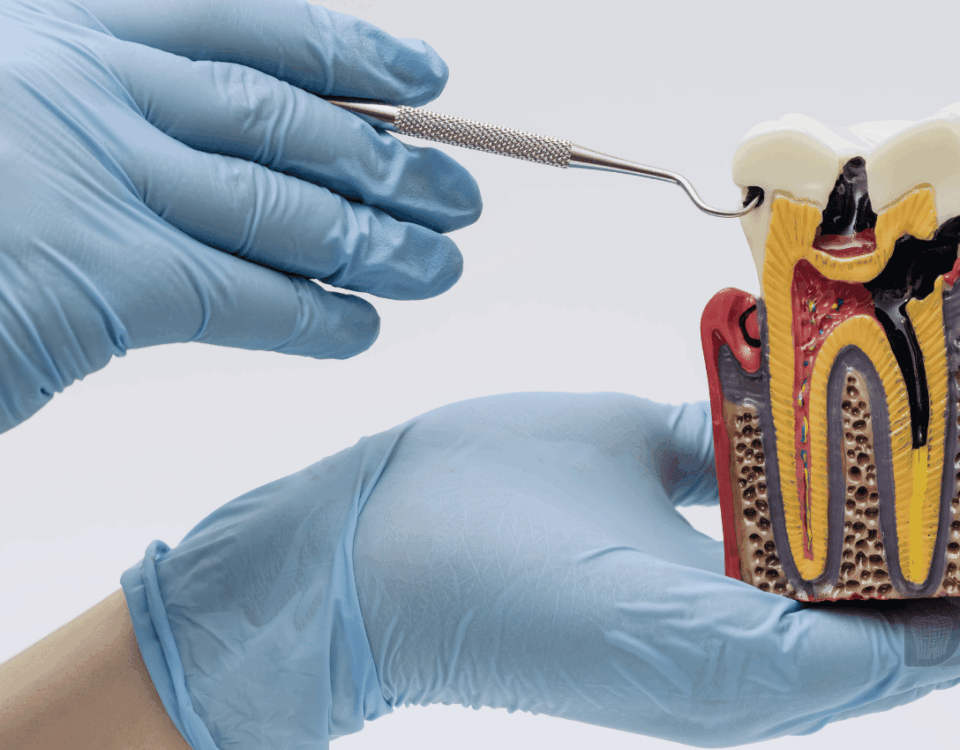 Endodoncia