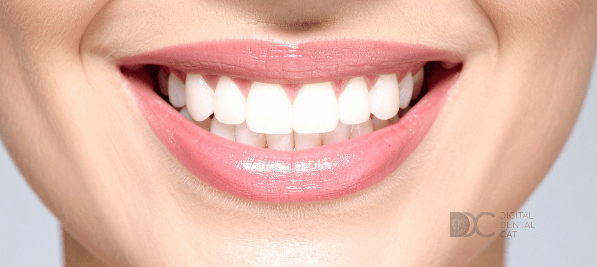 tratamiento sonrisa gingival