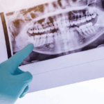 cirugía maxilofacial