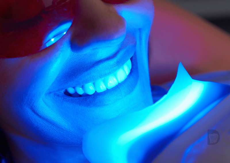 blanqueamiento dental